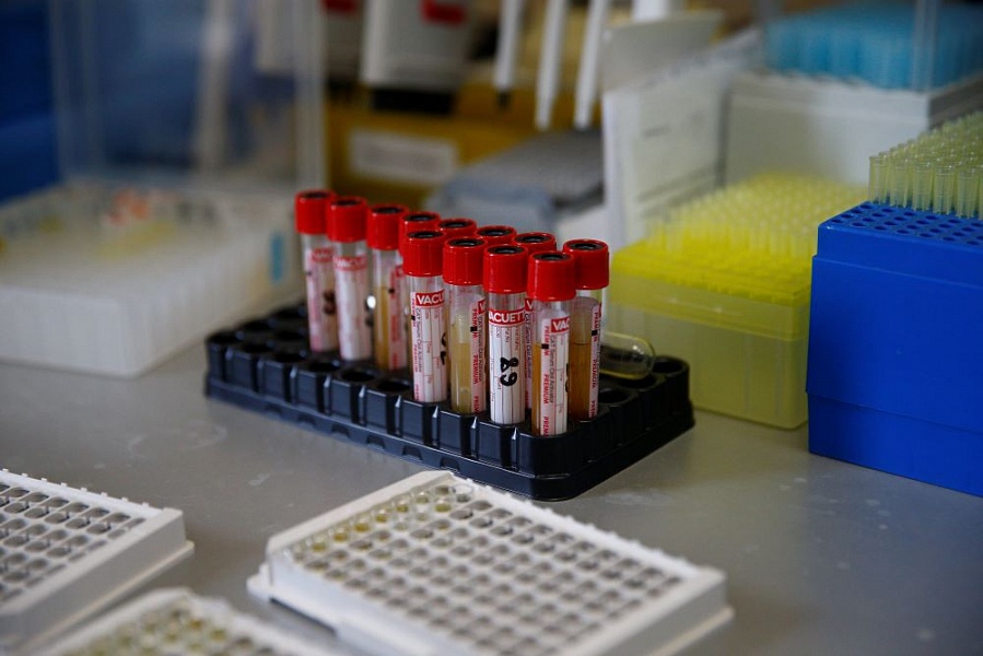 По данным на 5 мая в Динском районе под наблюдением врачей находится 82 жителя, за последние сутки на контроль никто не взят
